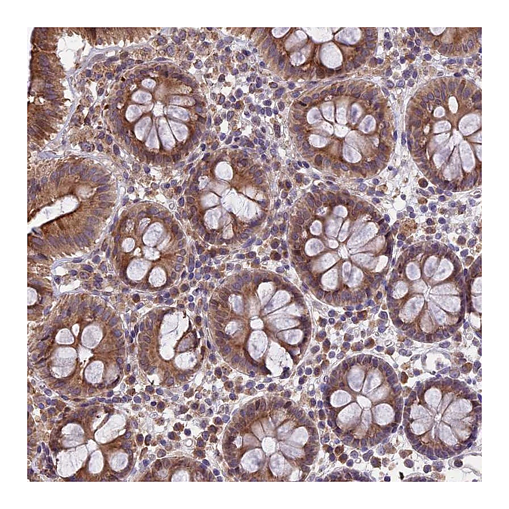 Atlas Antibodies Anti-DMRTA2 Antibody