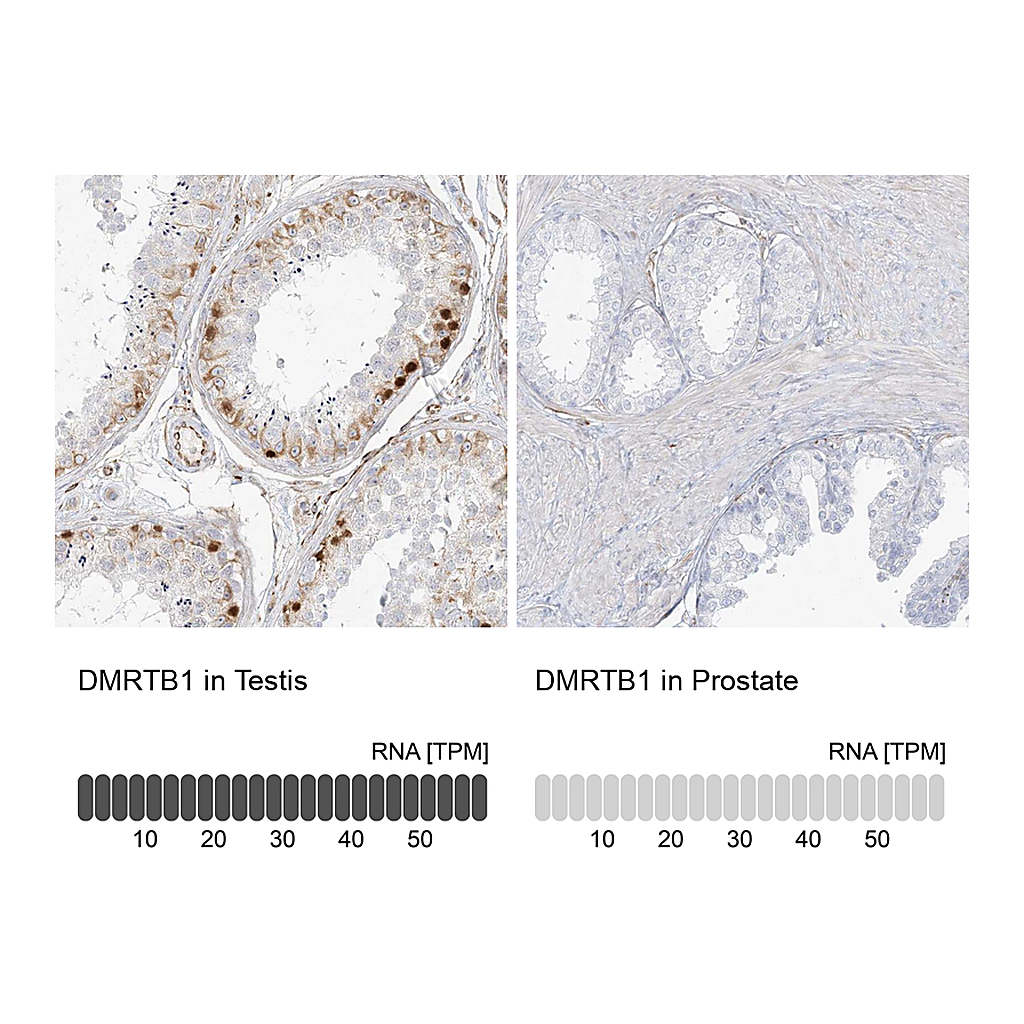 Atlas Antibodies Anti-DMRTB1 Antibody