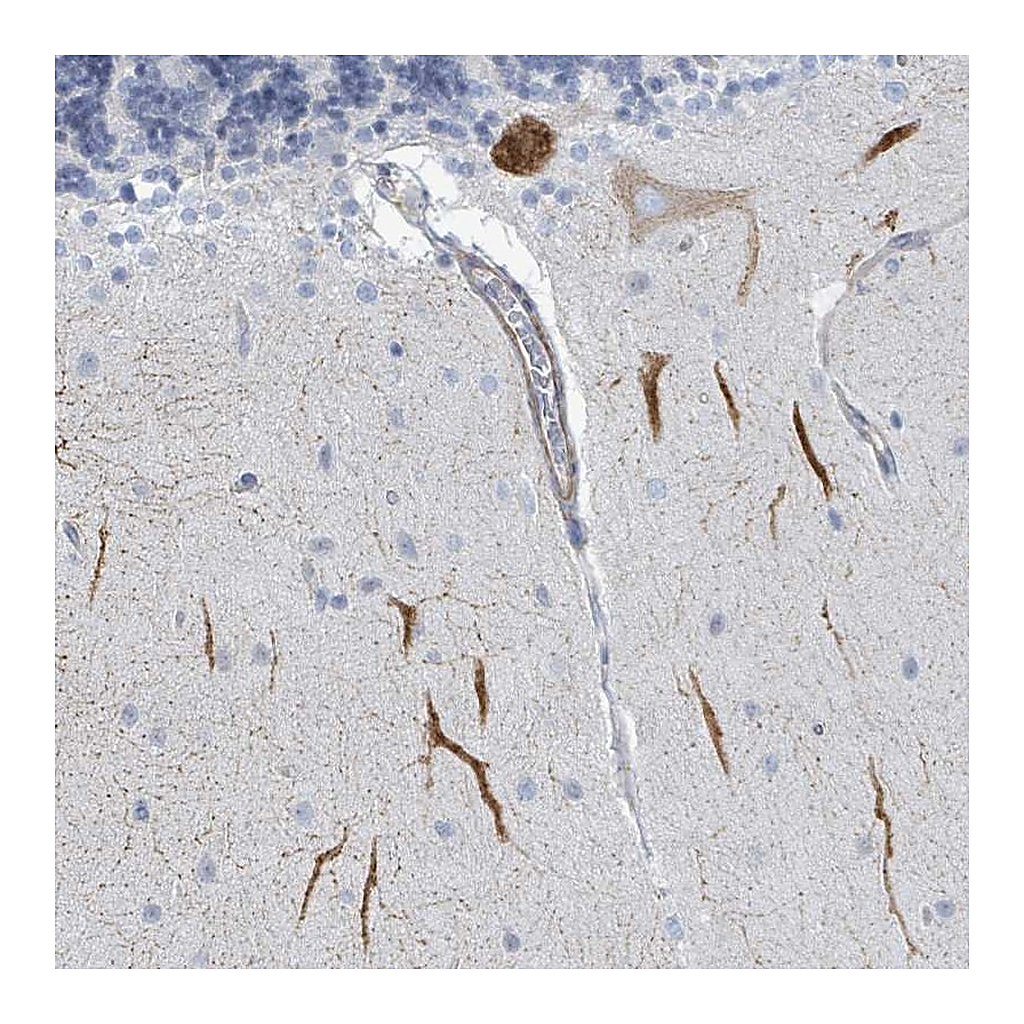 Atlas Antibodies Anti-DMRTC1 Antibody