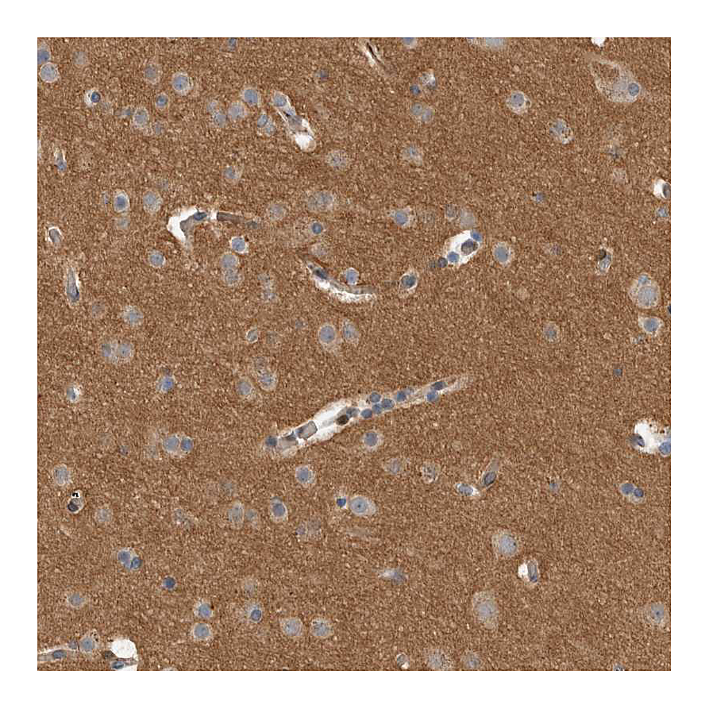Atlas Antibodies Anti-DMTN Antibody