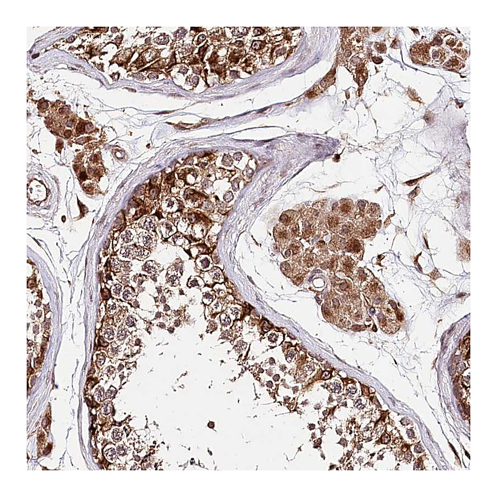 Atlas Antibodies Anti-DMXL1 Antibody