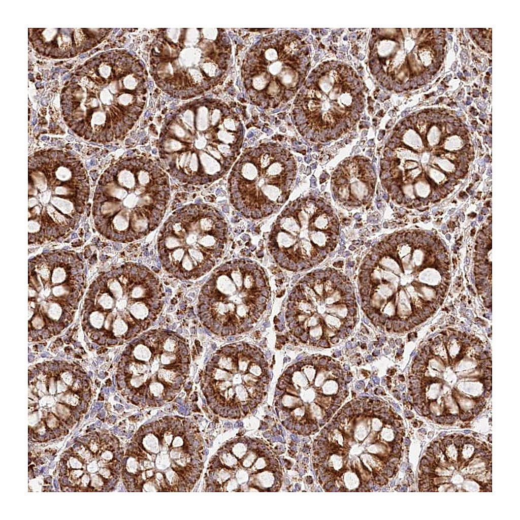 Atlas Antibodies Anti-DNA2 Antibody