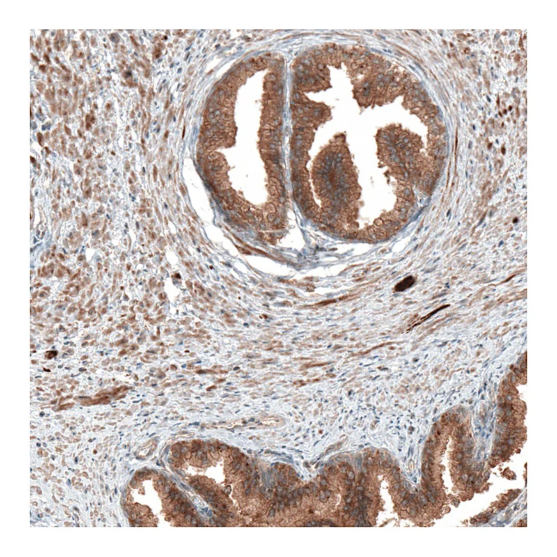 Atlas Antibodies Anti-DMXL1 Antibody