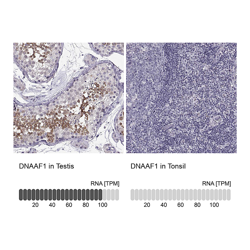 Atlas Antibodies Anti-DNAAF1 Antibody