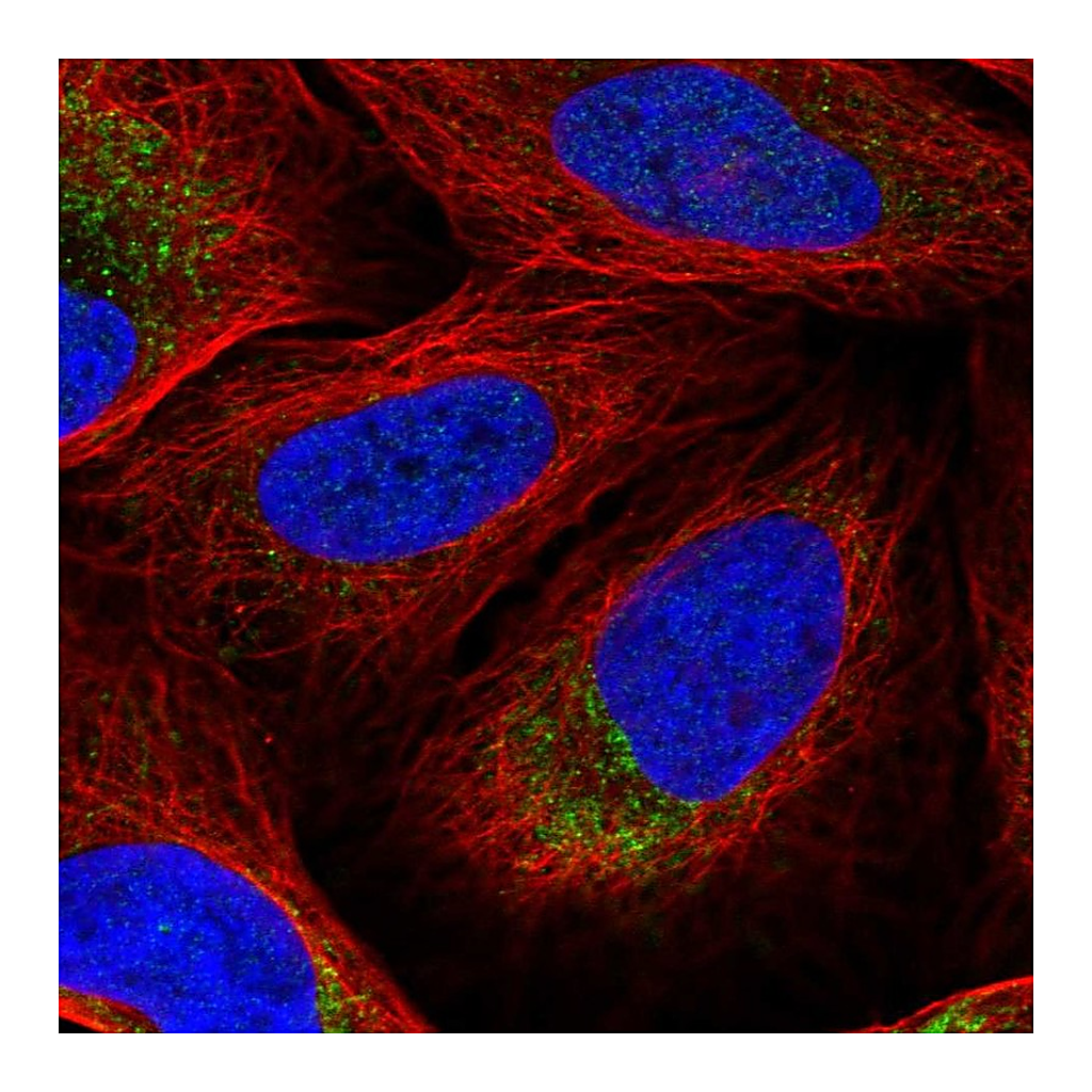 Atlas Antibodies Anti-DNA2 Antibody