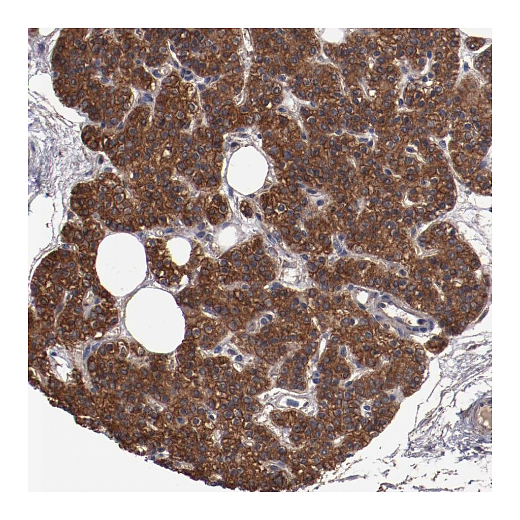 Atlas Antibodies Anti-DNAAF2 Antibody