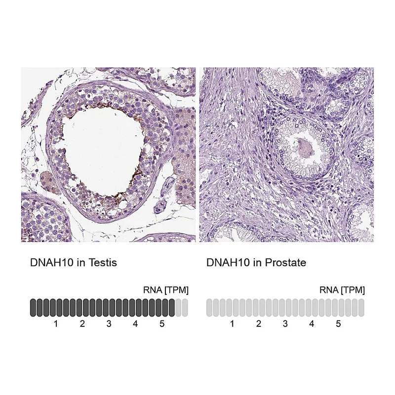 Atlas Antibodies Anti-DNAH10 Antibody