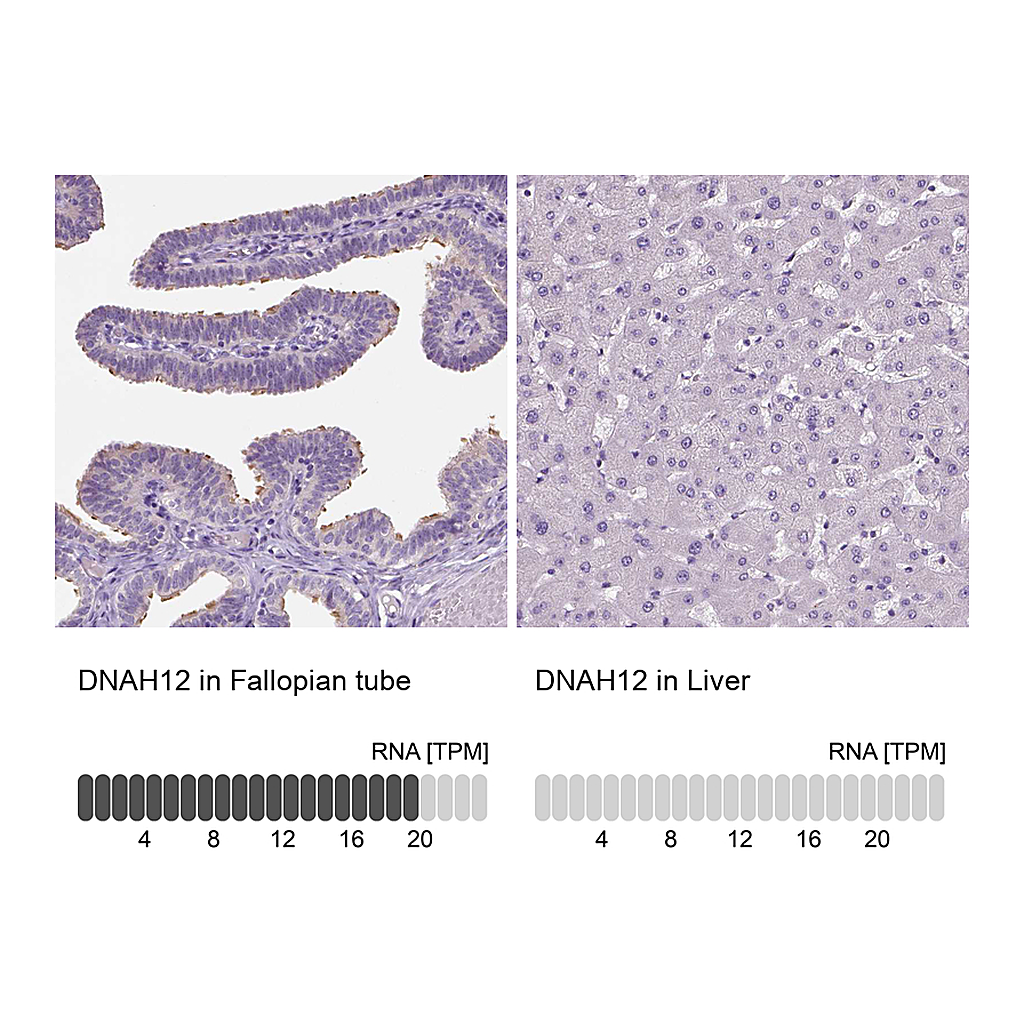 Atlas Antibodies Anti-DNAH12 Antibody