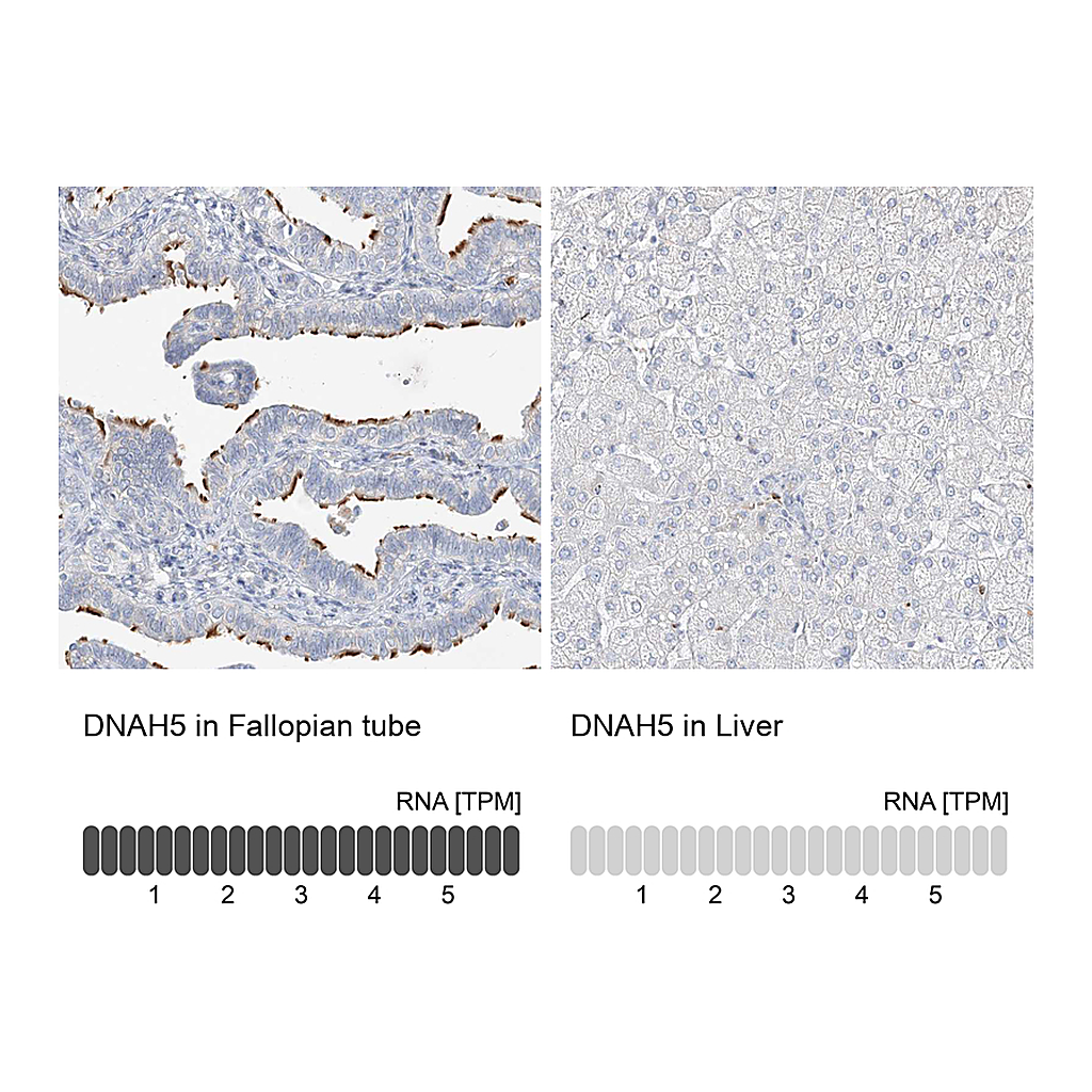 Atlas Antibodies Anti-DNAH5 Antibody