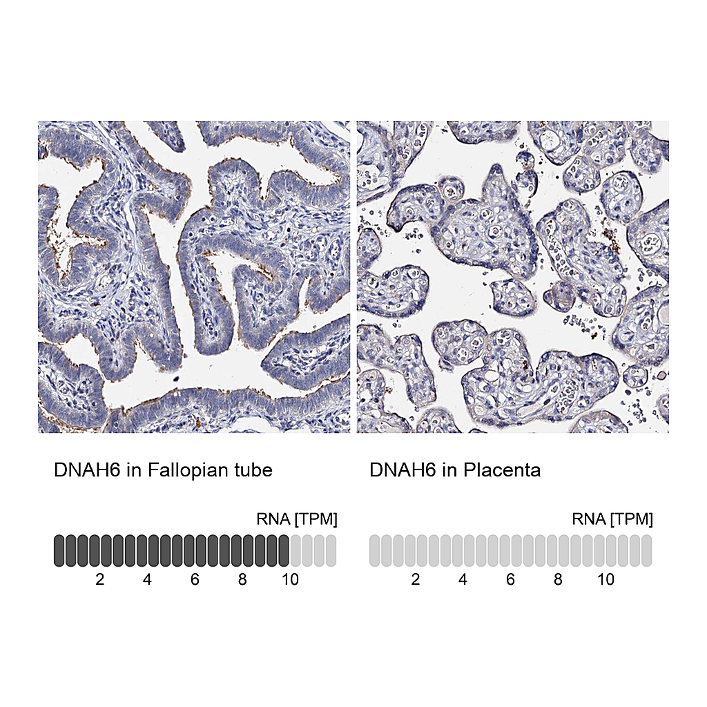 Atlas Antibodies Anti-DNAH6 Antibody