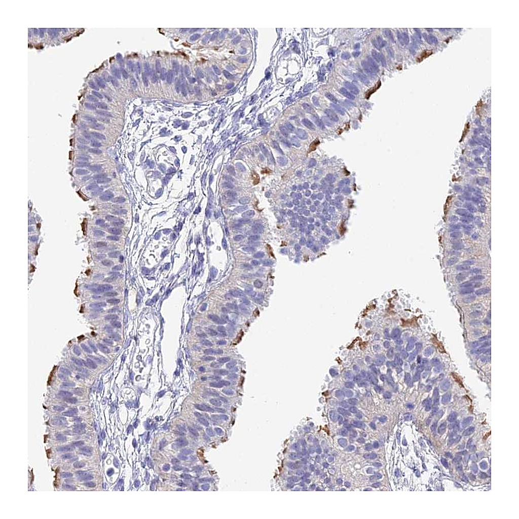 Atlas Antibodies Anti-DNAH14 Antibody