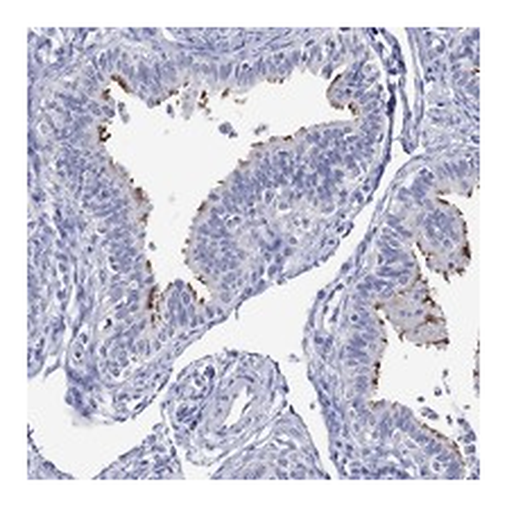 Atlas Antibodies Anti-DNAH6 Antibody