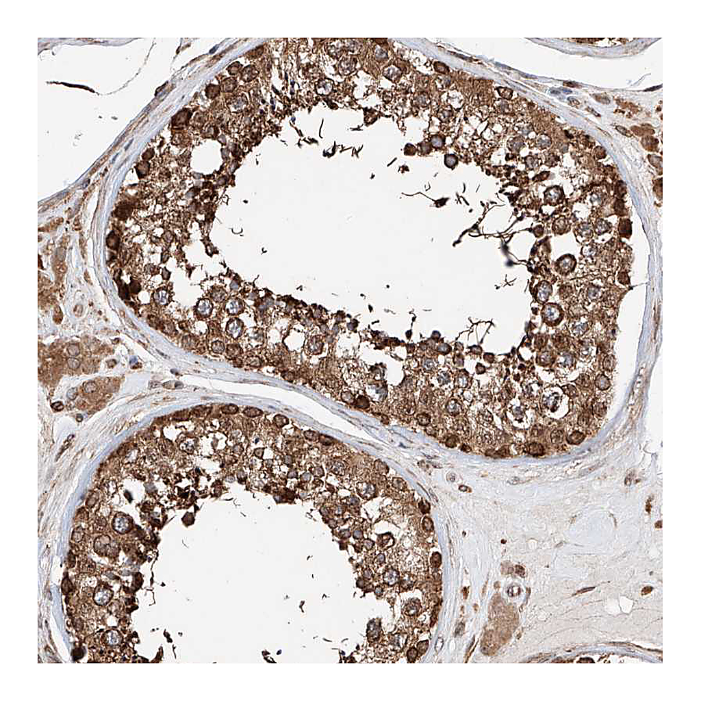 Atlas Antibodies Anti-DNAH8 Antibody