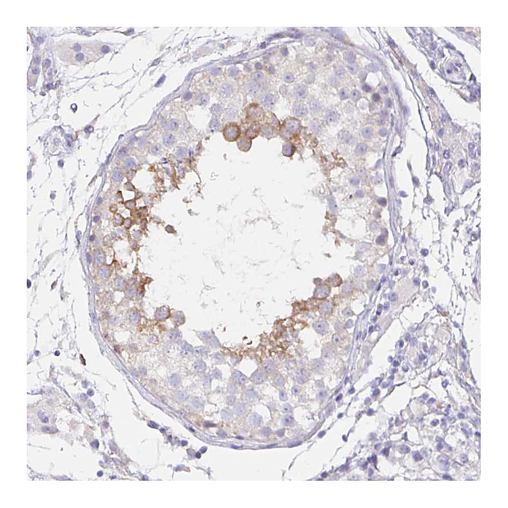 Atlas Antibodies Anti-DNAI2 Antibody