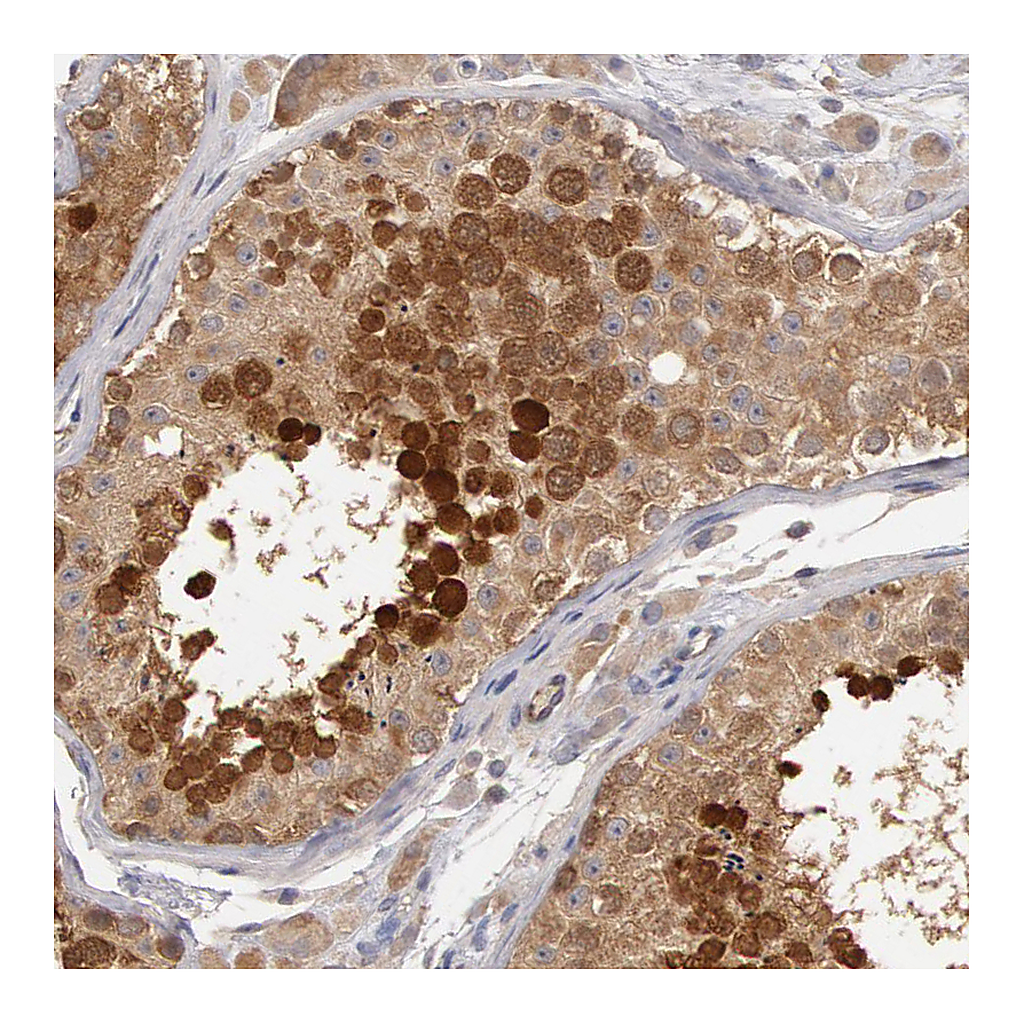 Atlas Antibodies Anti-DNAJA1 Antibody