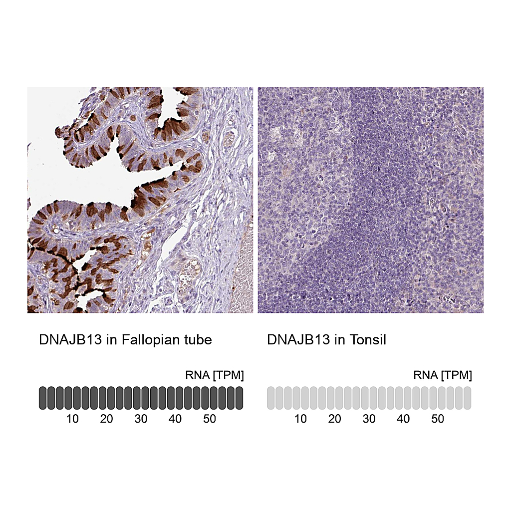 Atlas Antibodies Anti-DNAJB13 Antibody