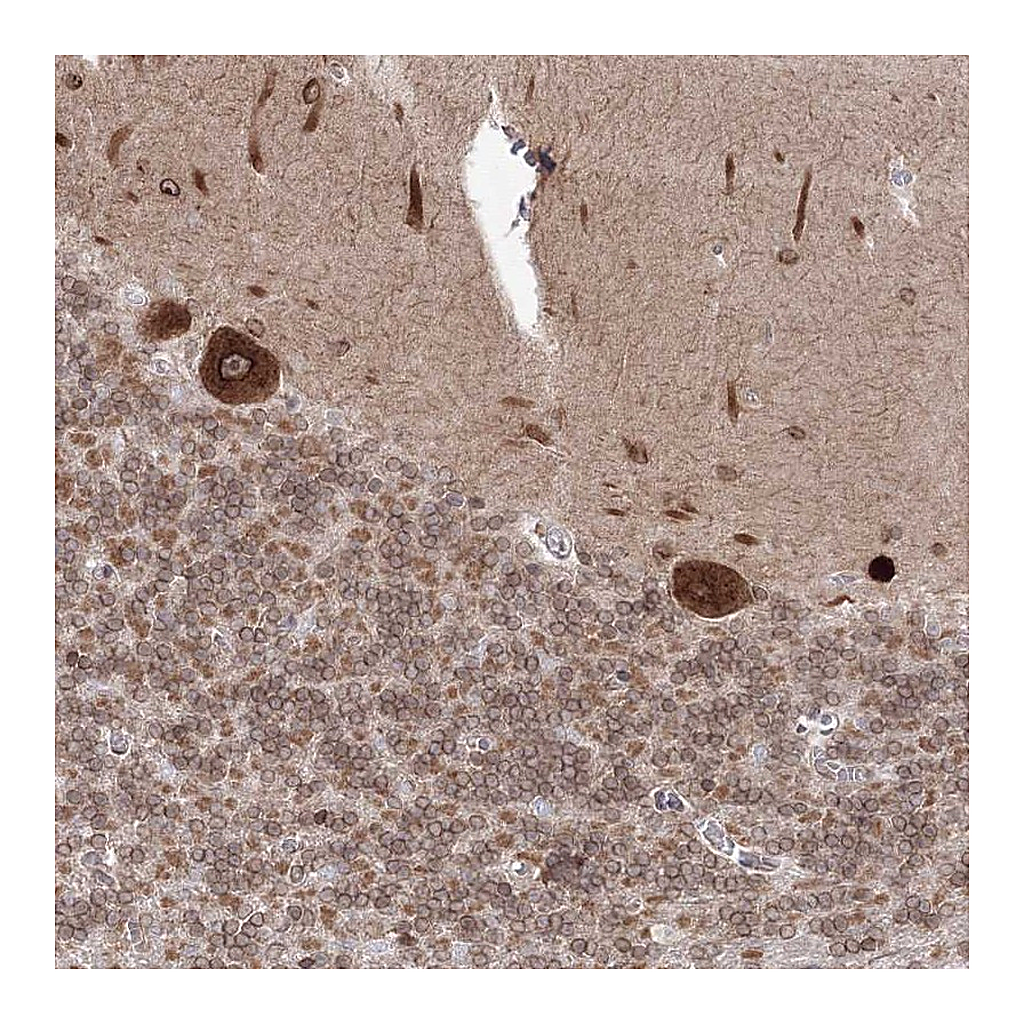 Atlas Antibodies Anti-DNAJB2 Antibody