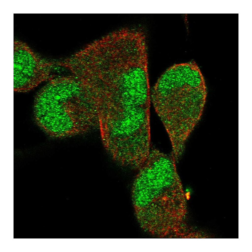Atlas Antibodies Anti-DNAJB5 Antibody
