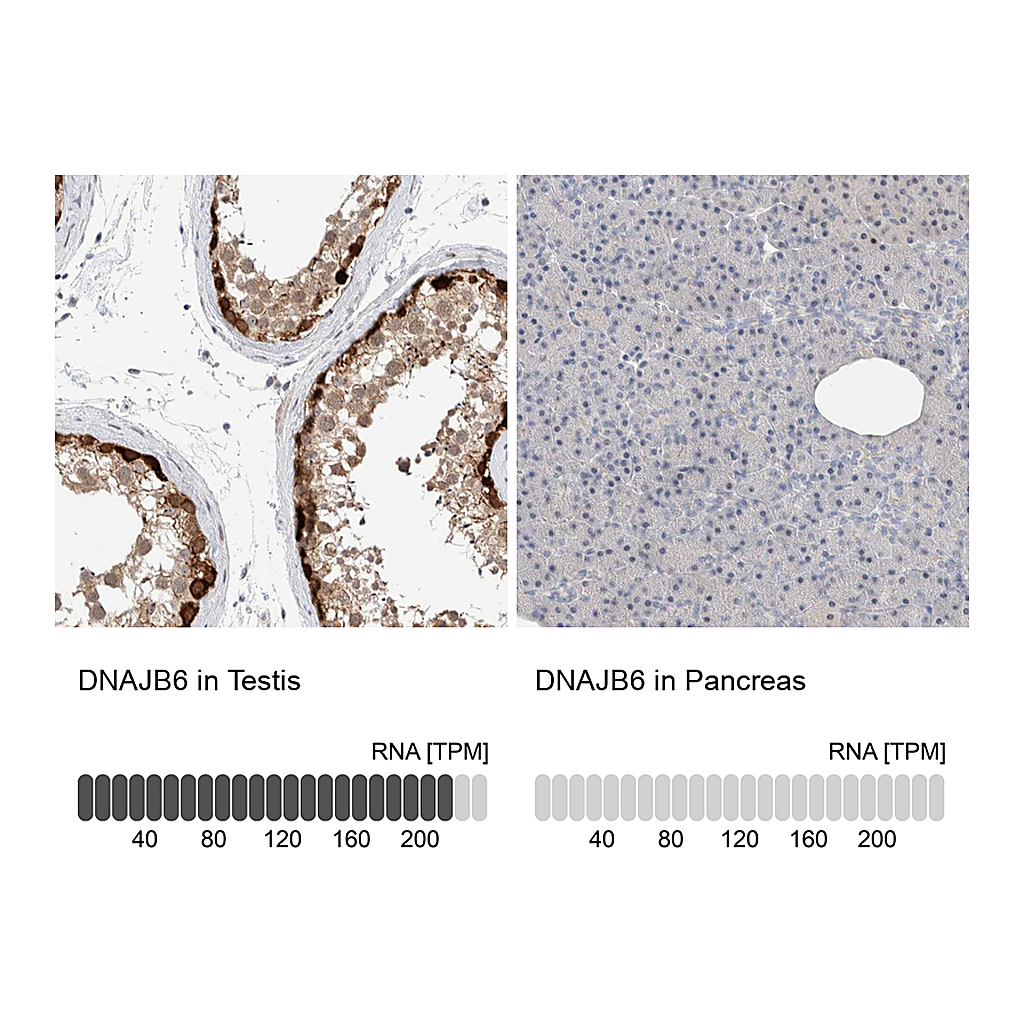 Atlas Antibodies Anti-DNAJB6 Antibody