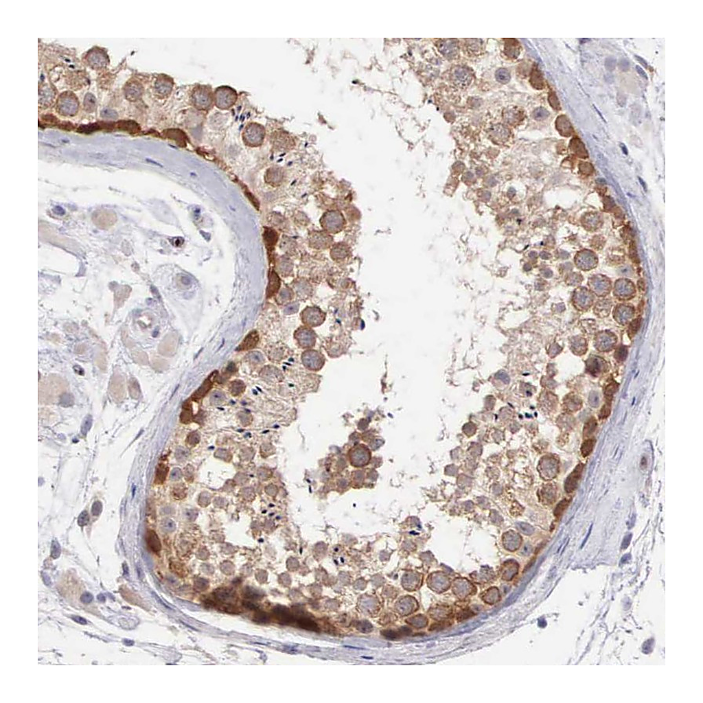 Atlas Antibodies Anti-DNAJB7 Antibody