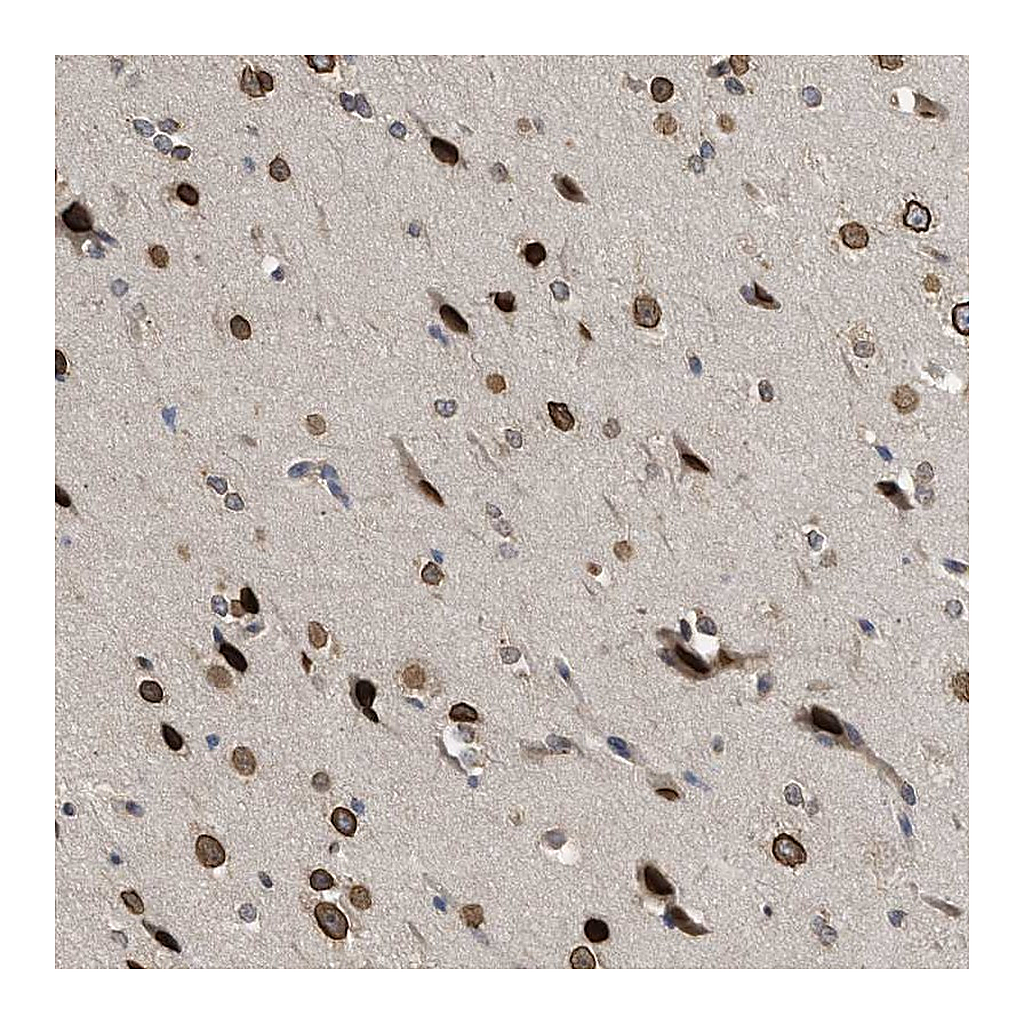 Atlas Antibodies Anti-DNAJC1 Antibody
