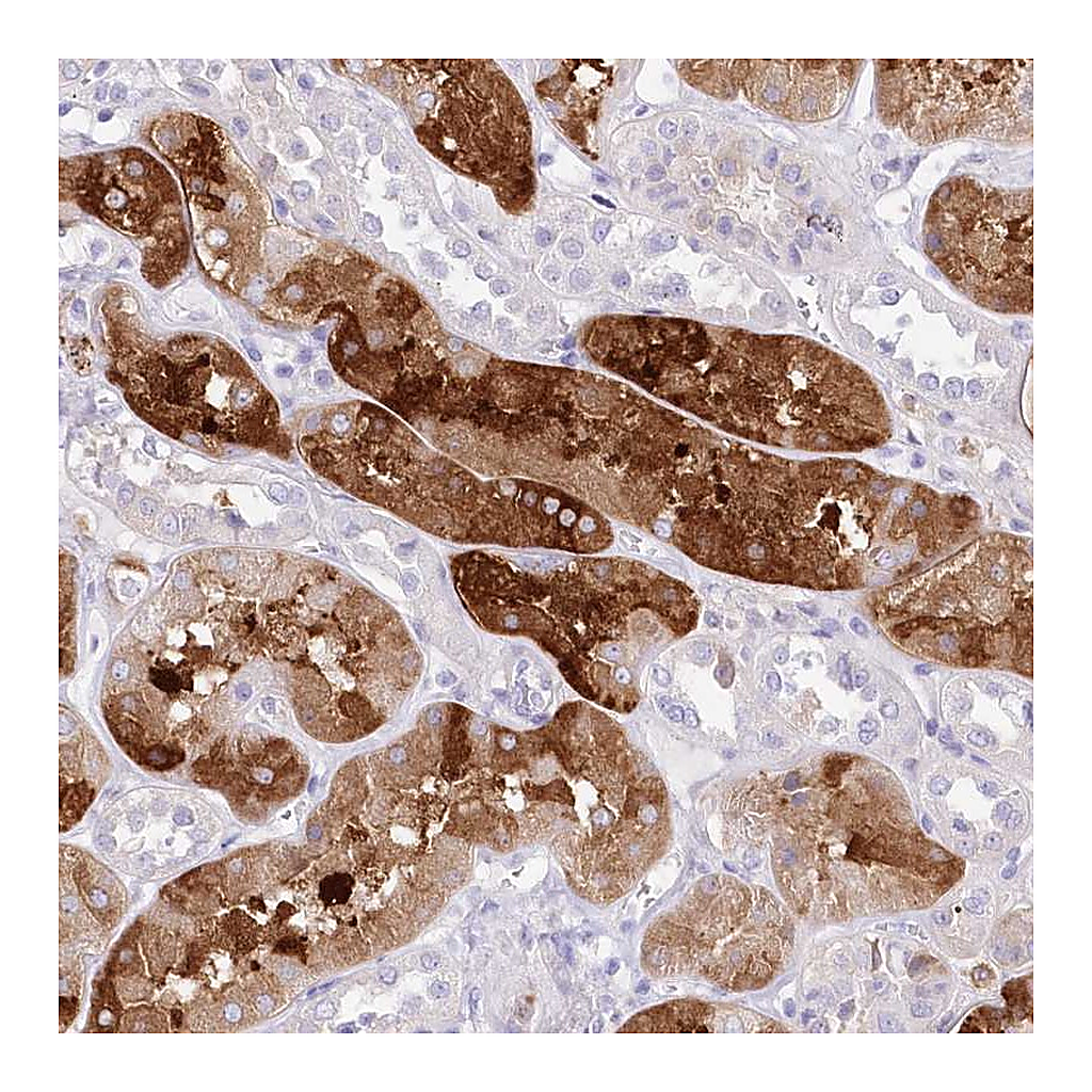 Atlas Antibodies Anti-DNAJC19 Antibody