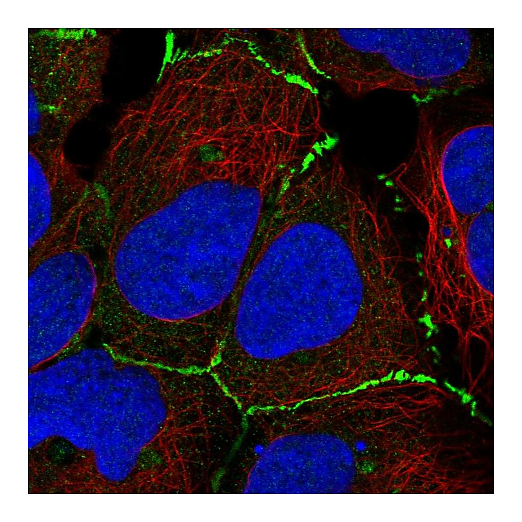 Atlas Antibodies Anti-DNAJC18 Antibody