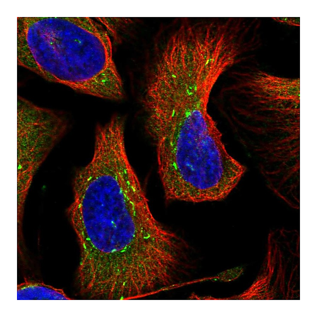 Atlas Antibodies Anti-DNAJC21 Antibody