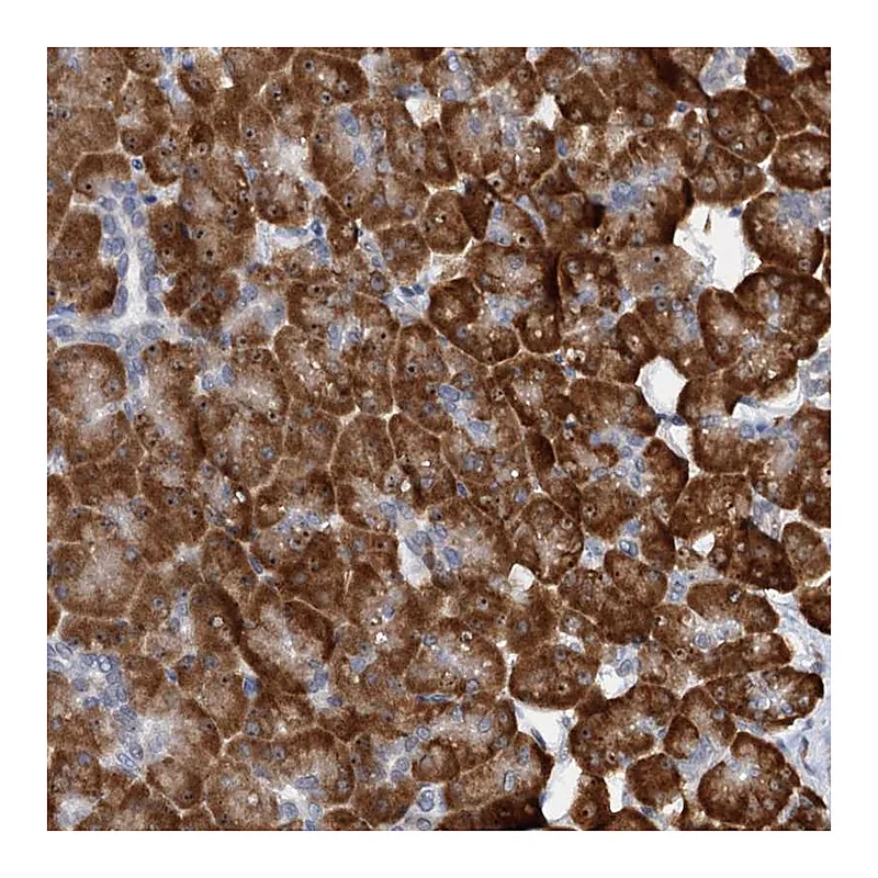 Atlas Antibodies Anti-DNAJC21 Antibody