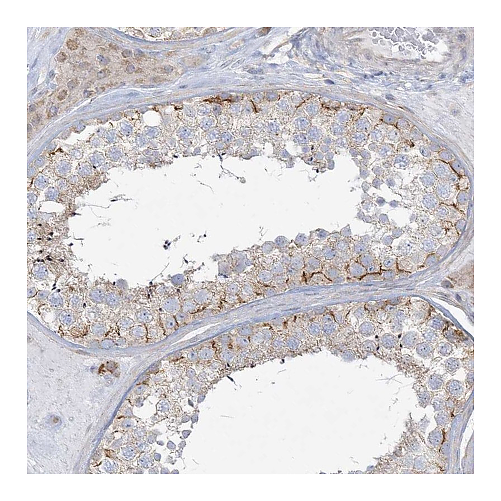 Atlas Antibodies Anti-DNAJC18 Antibody