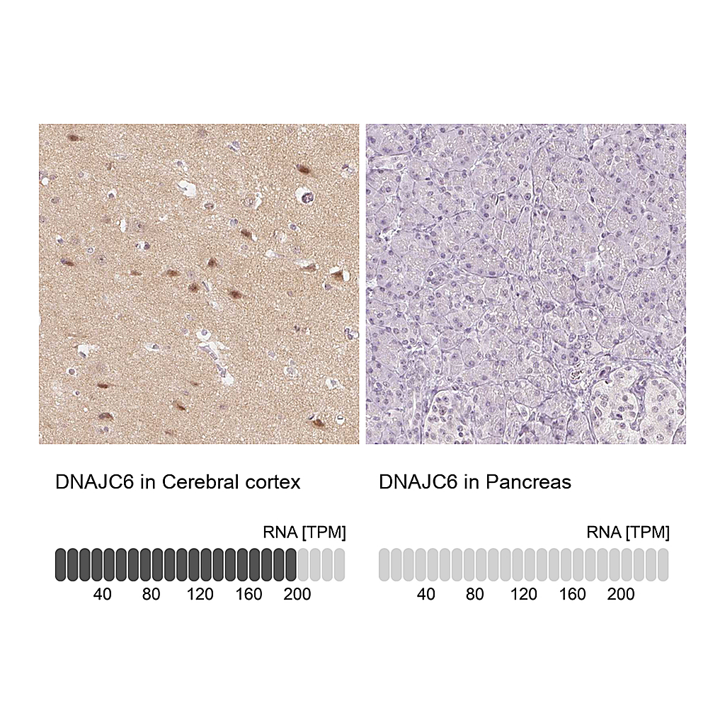 Atlas Antibodies Anti-DNAJC6 Antibody