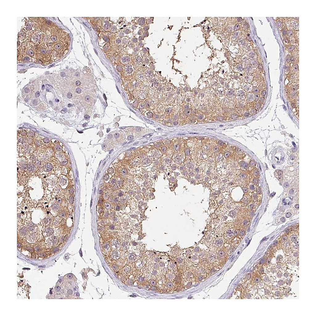Atlas Antibodies Anti-DNAJC5G Antibody