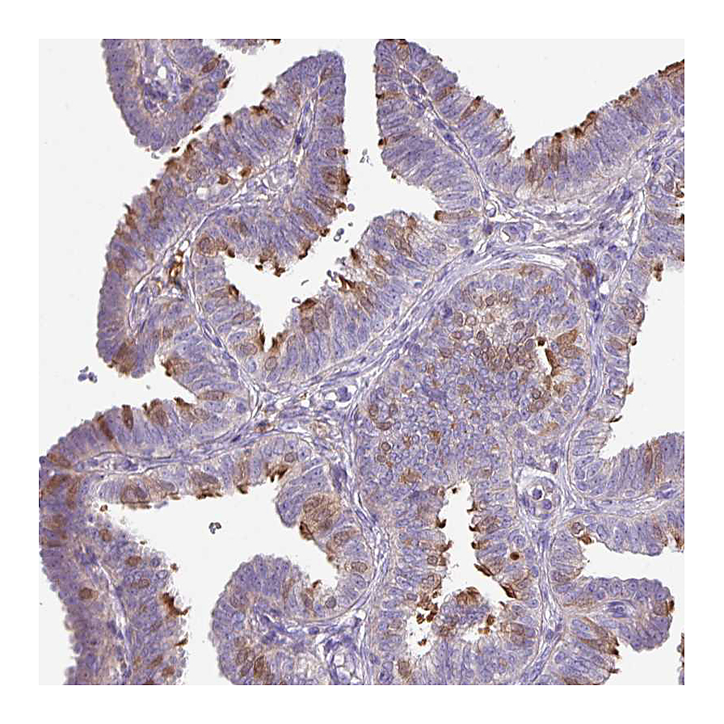 Atlas Antibodies Anti-DNAL1 Antibody