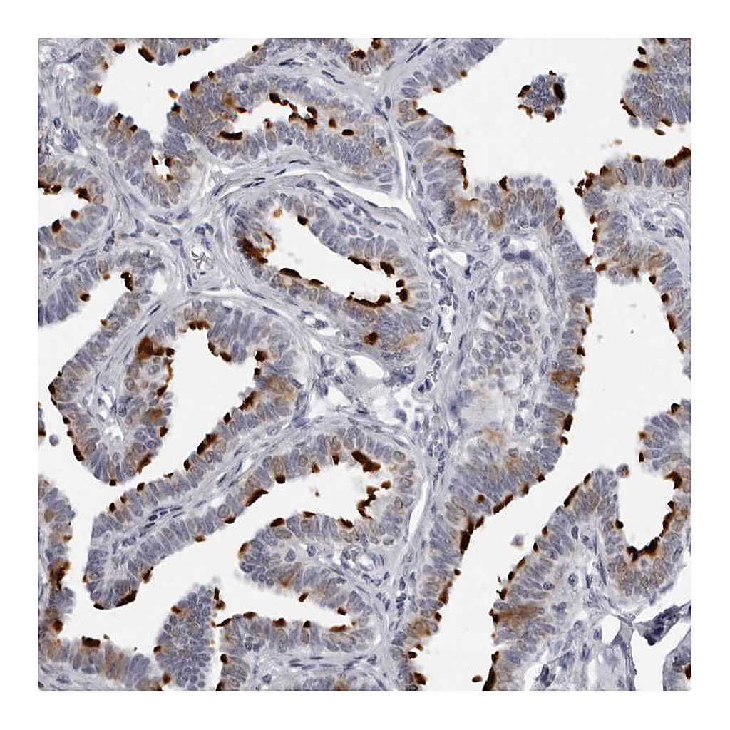 Atlas Antibodies Anti-DNALI1 Antibody