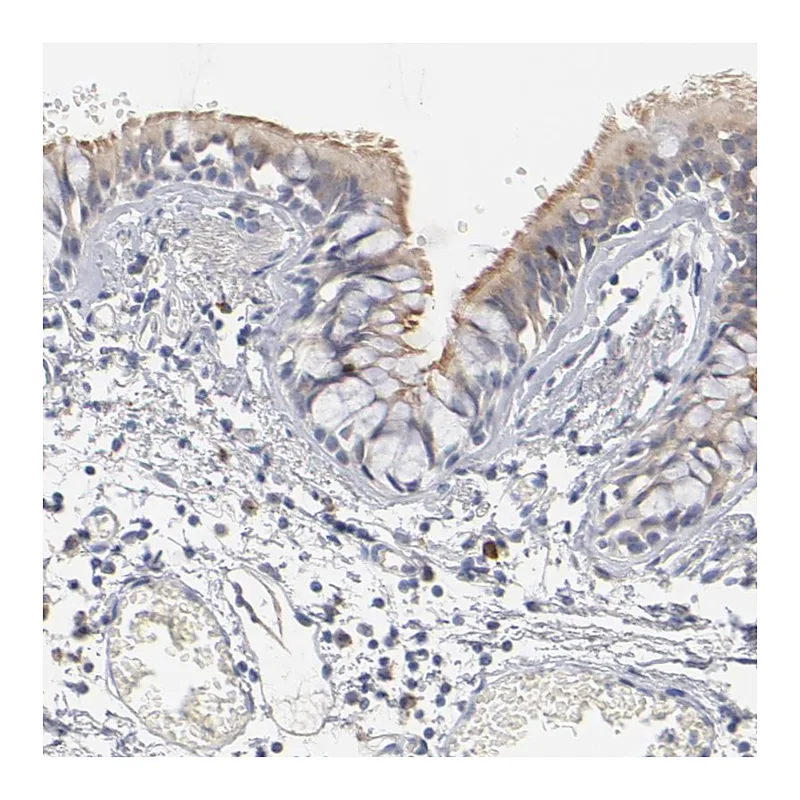 Atlas Antibodies Anti-DNAL4 Antibody