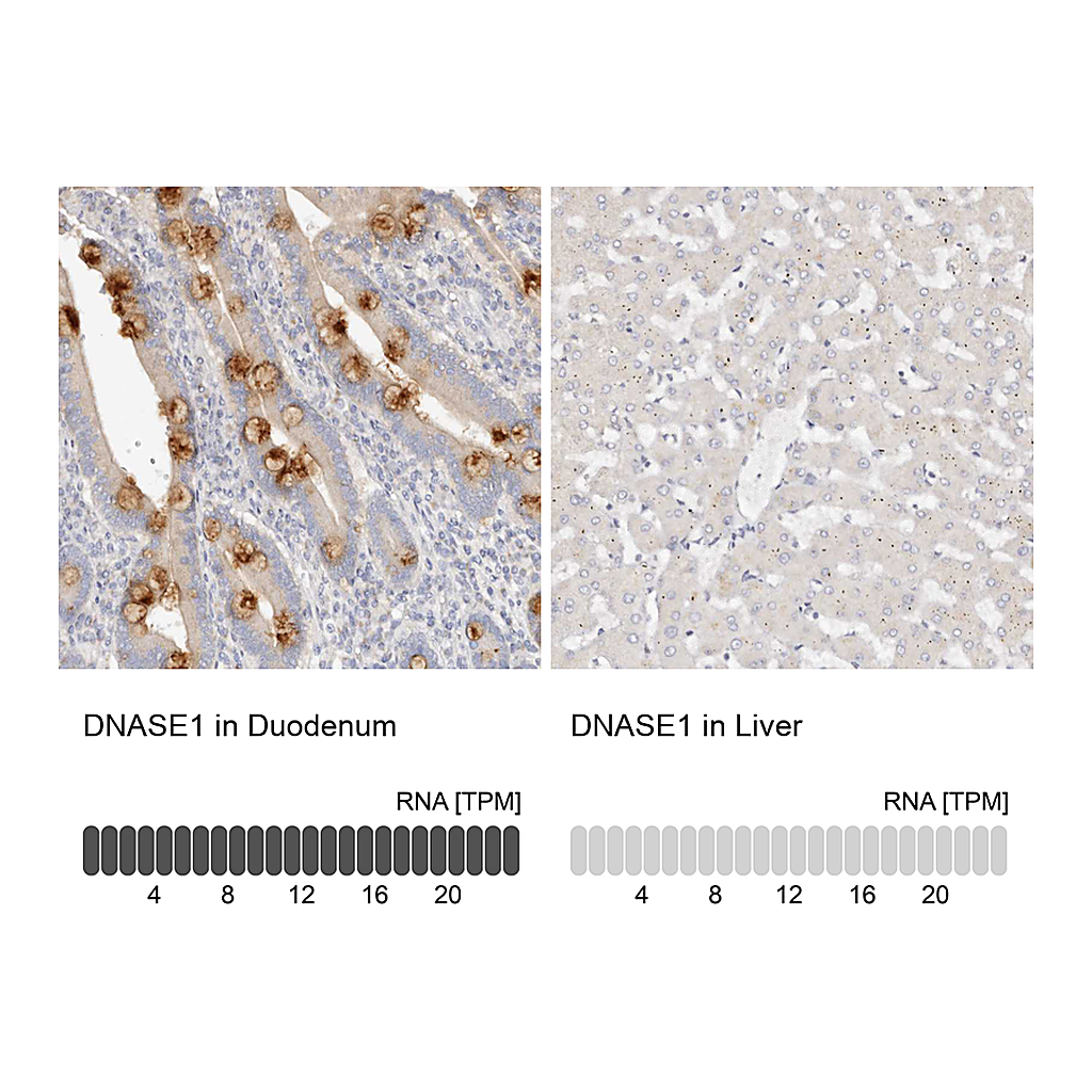 Atlas Antibodies Anti-DNASE1 Antibody