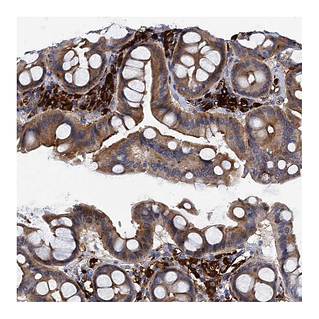 Atlas Antibodies Anti-DNHD1 Antibody