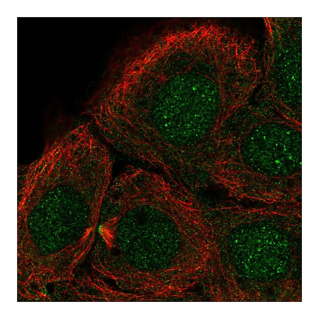 Atlas Antibodies Anti-DNHD1 Antibody