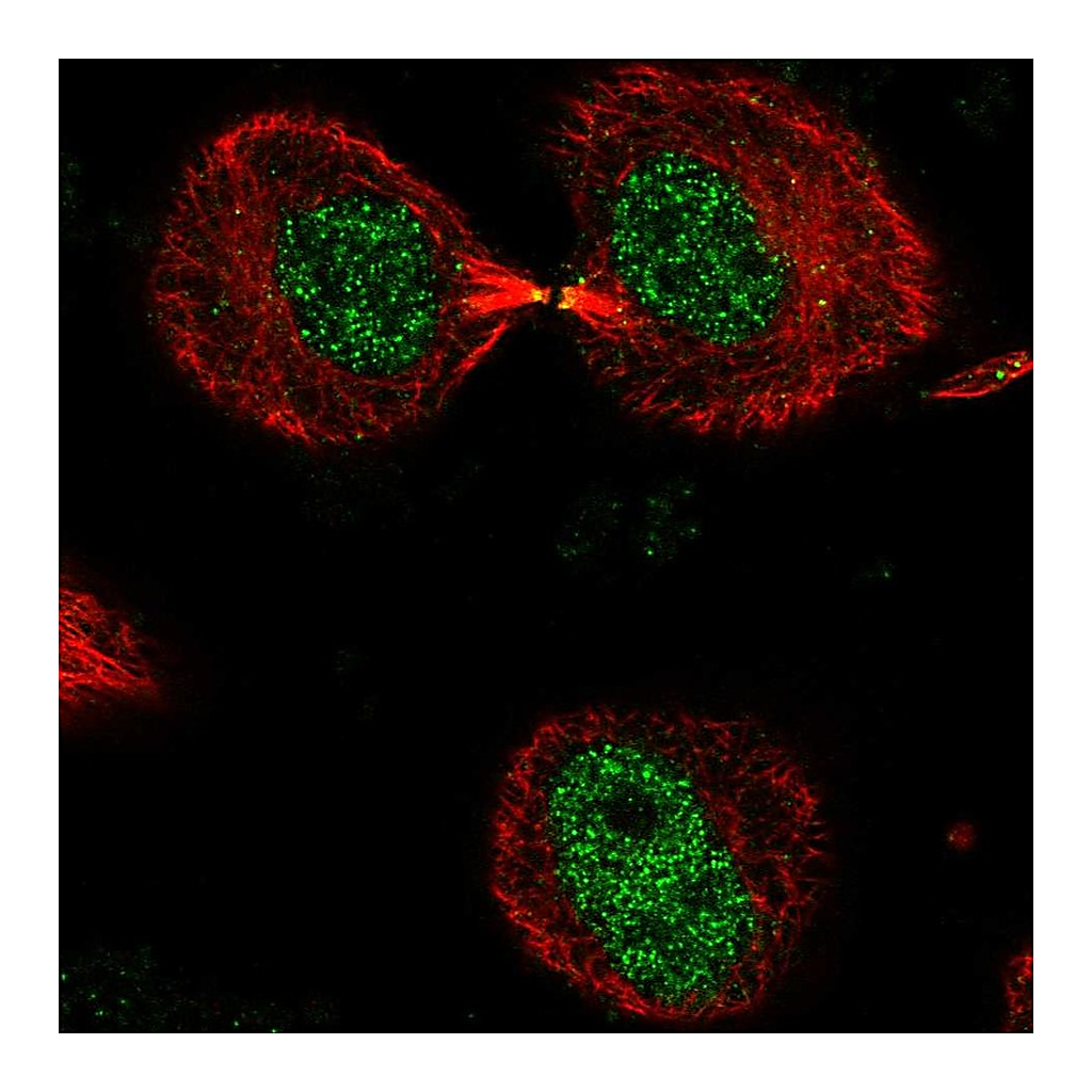 Atlas Antibodies Anti-DNHD1 Antibody
