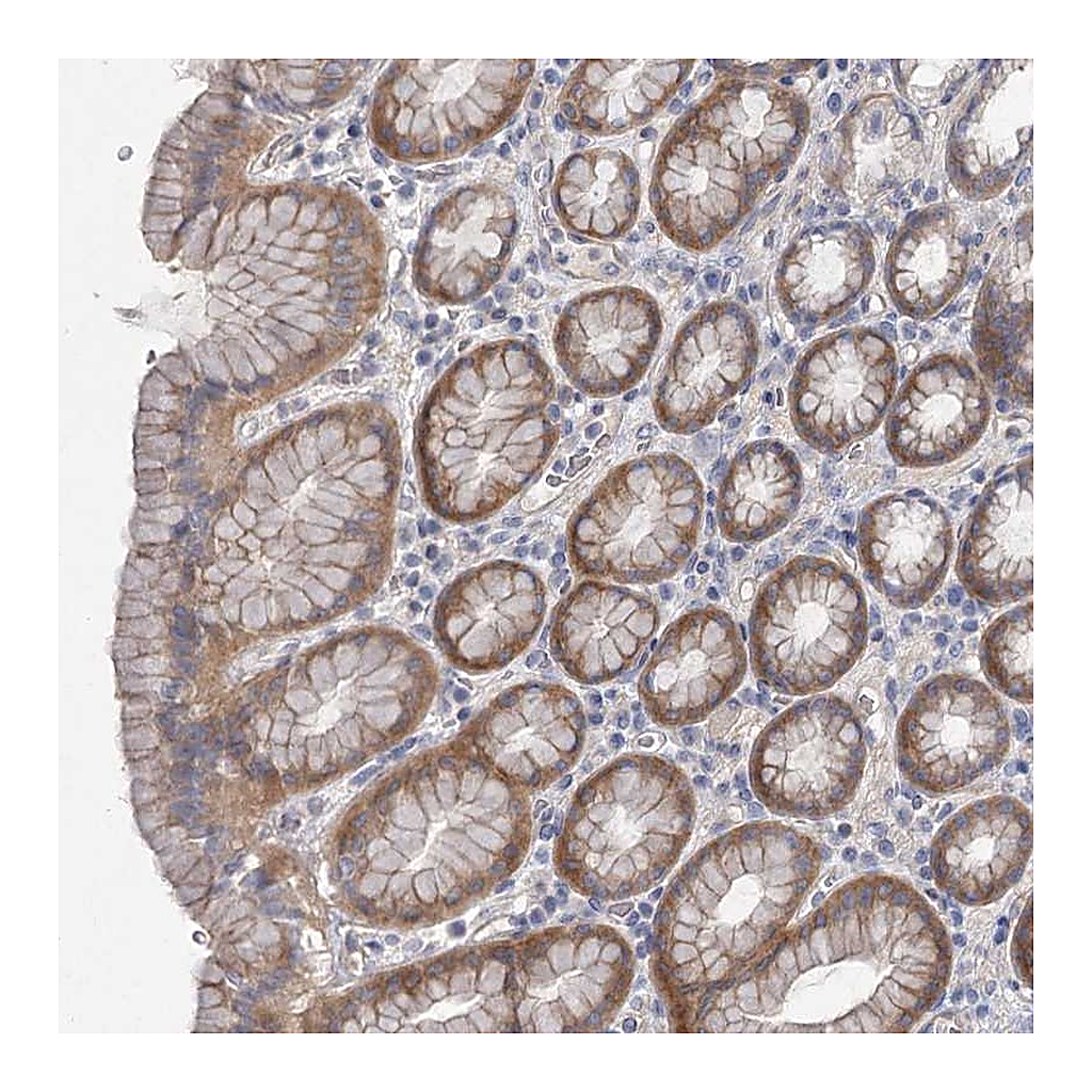 Atlas Antibodies Anti-DNMBP Antibody