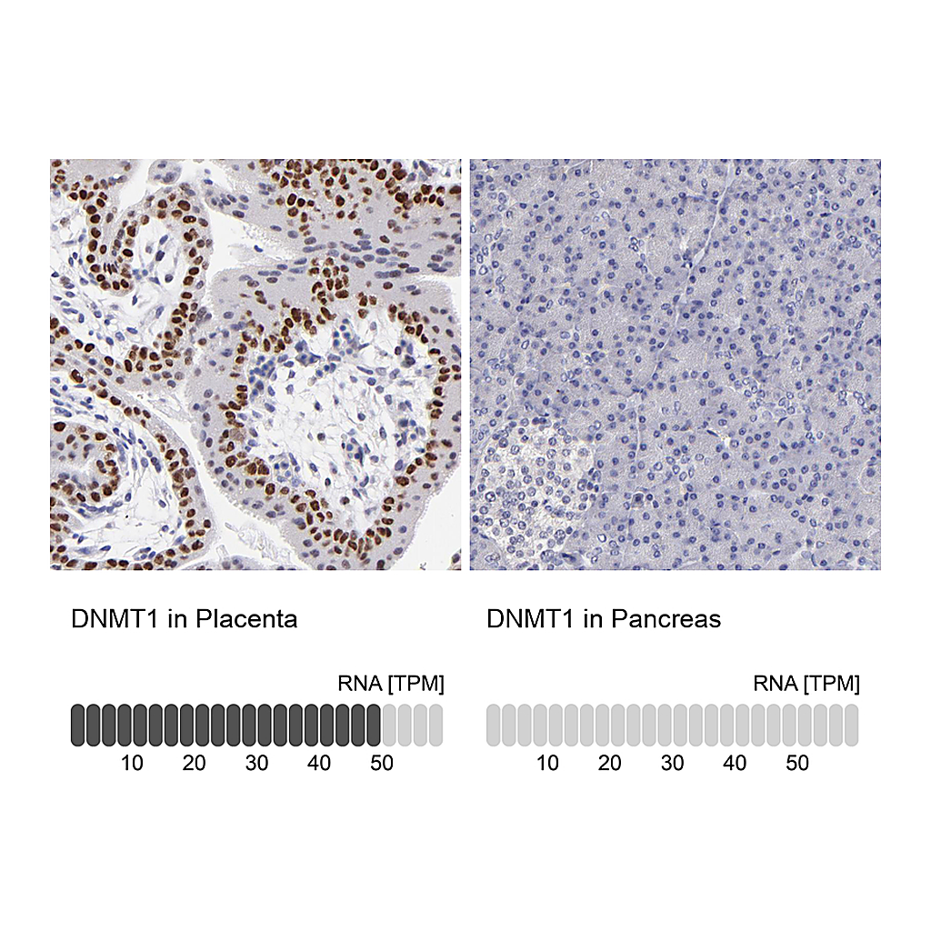 Atlas Antibodies Anti-DNMT1 Antibody