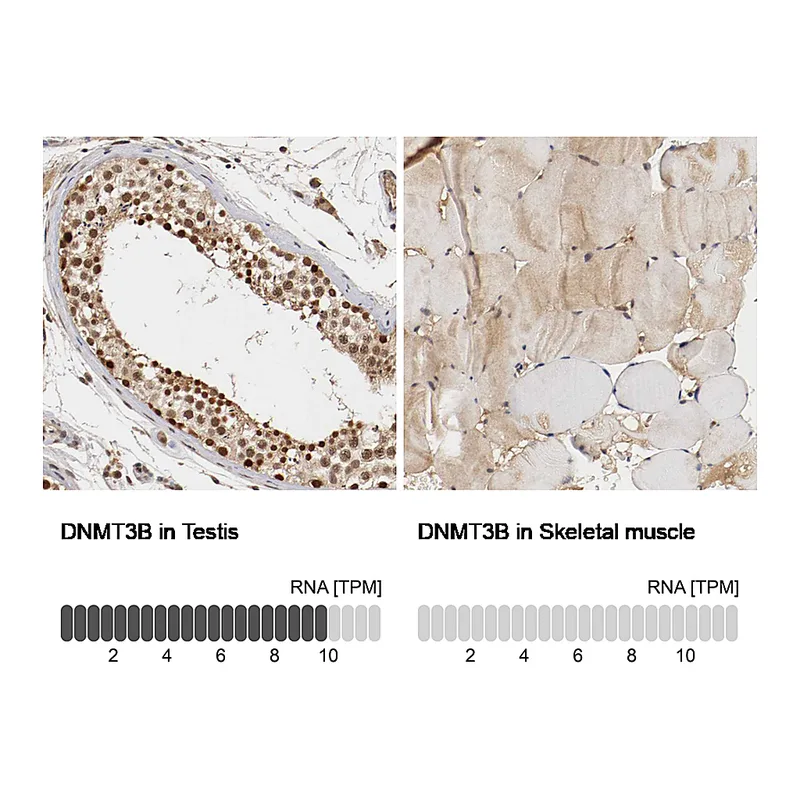 Atlas Antibodies Anti-DNMT3B Antibody