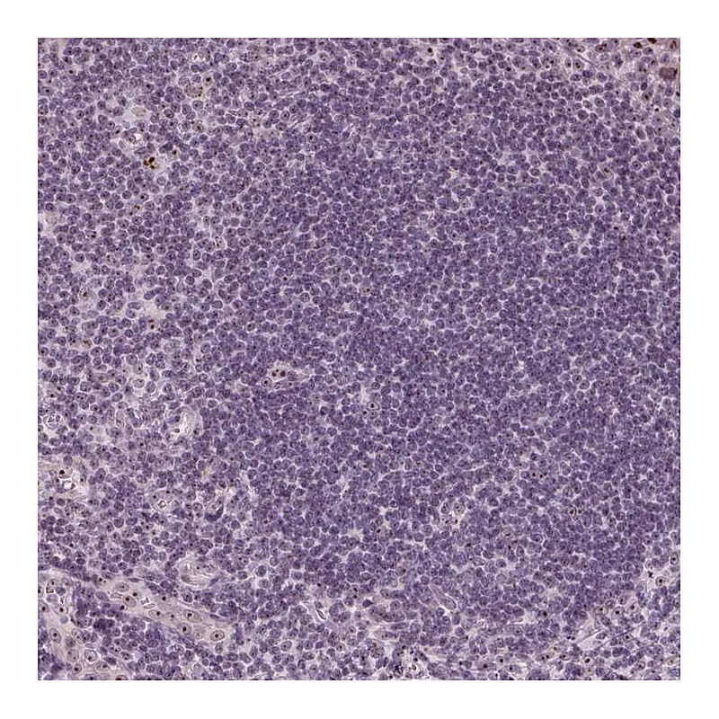 Atlas Antibodies Anti-DNTTIP2 Antibody