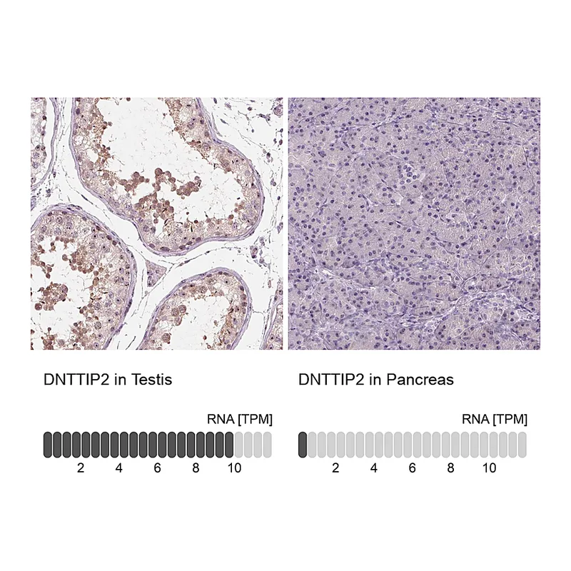 Atlas Antibodies Anti-DNTTIP2 Antibody