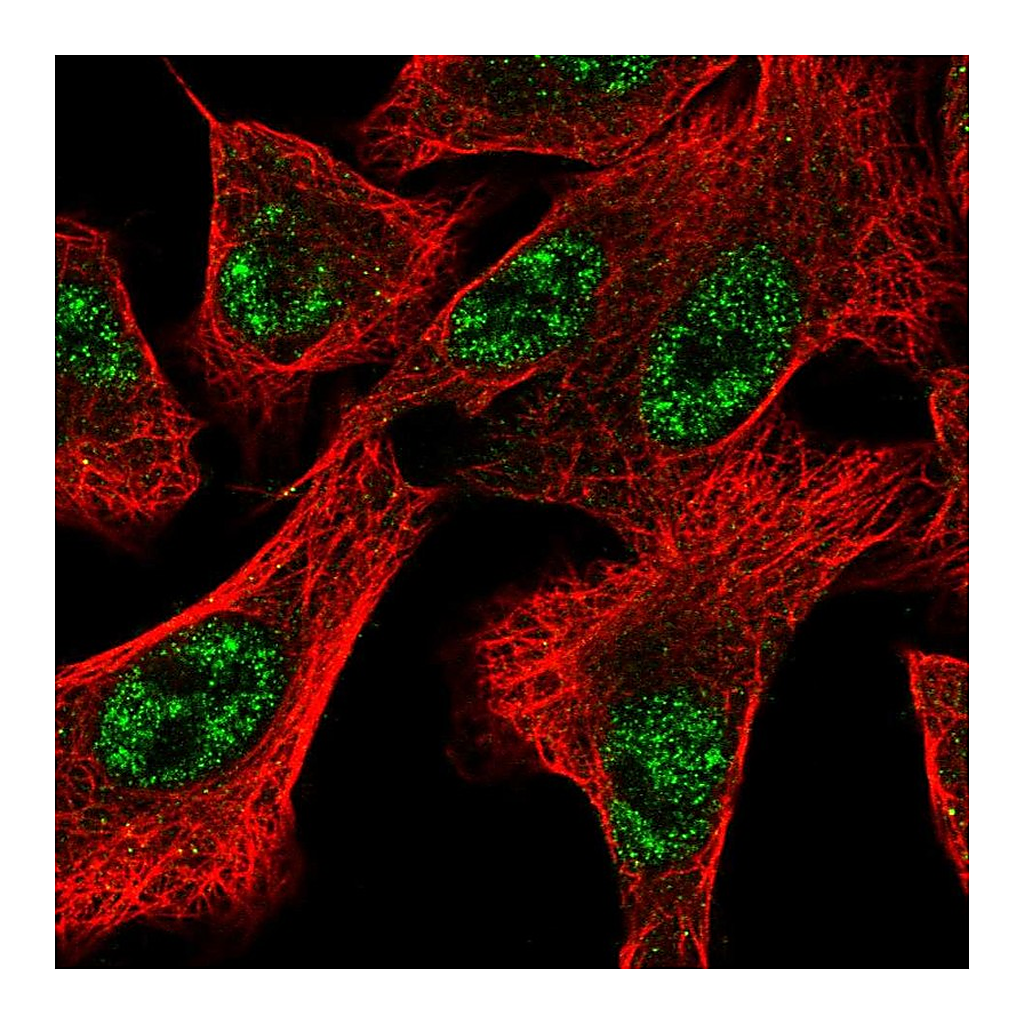 Atlas Antibodies Anti-DOCK1 Antibody