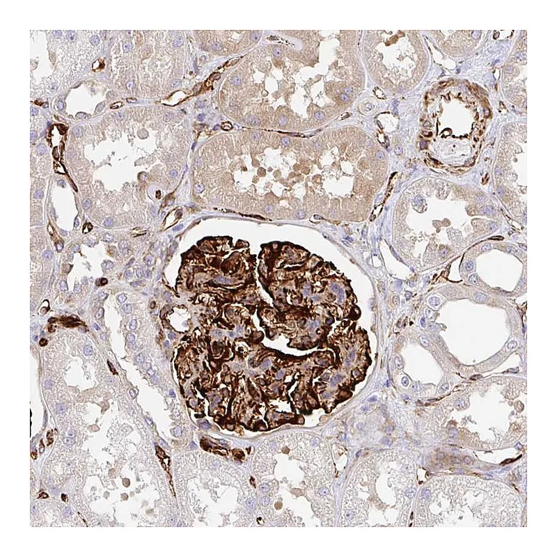 Atlas Antibodies Anti-DOCK1 Antibody