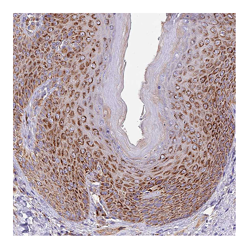 Atlas Antibodies Anti-DOCK6 Antibody