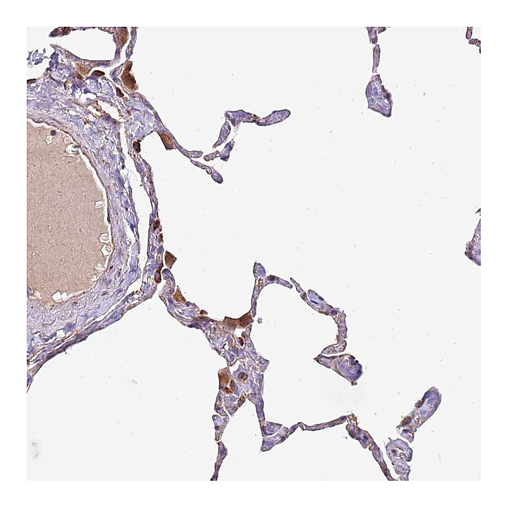Atlas Antibodies Anti-DOCK6 Antibody