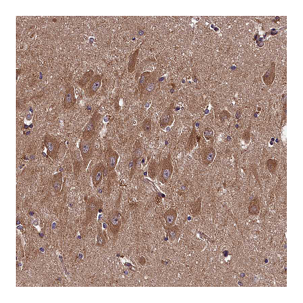 Atlas Antibodies Anti-DOHH Antibody
