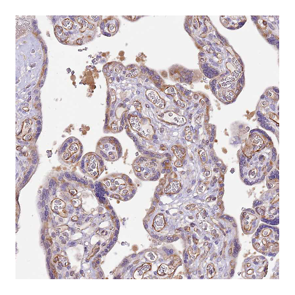 Atlas Antibodies Anti-DOCK9 Antibody